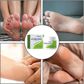 South Moon - 42% Urea Cream + 2% Salicylic Acid (Original)